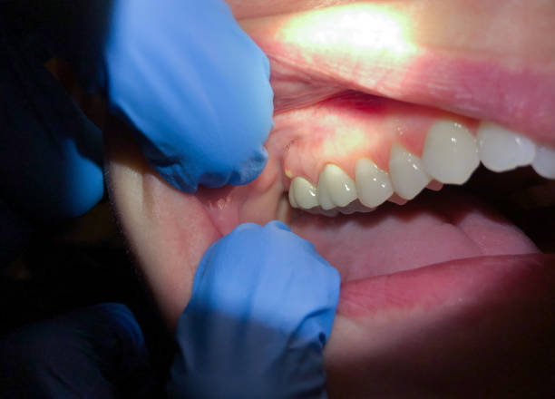 Best Cosmetic Emergency Dentistry in Minot Af, ND