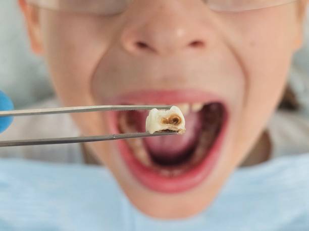 Best Emergency Gum Treatment in Minot Af, ND